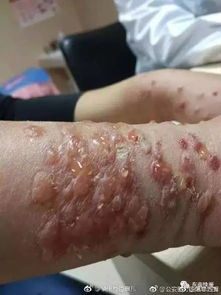 六、情感与人际关系：小虫子背后隐藏的大人物？