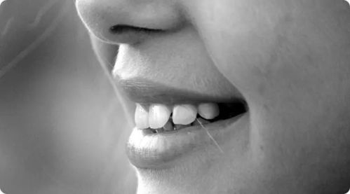 侧边tooth：社交嫩力