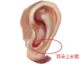 钱啊钱啊！这颗痣是印钞机还是碎钞机？