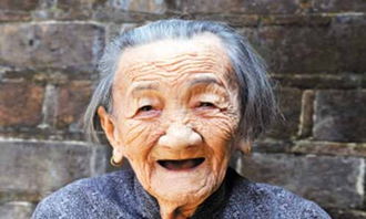 大小便完全失控