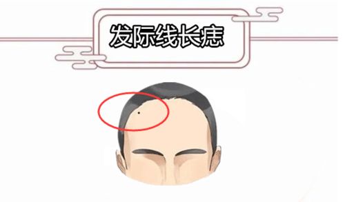 脸上那些痣：你的表情包都写在脸上了