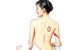 脑袋上的黑点点：聪明绝顶or倒霉透顶？