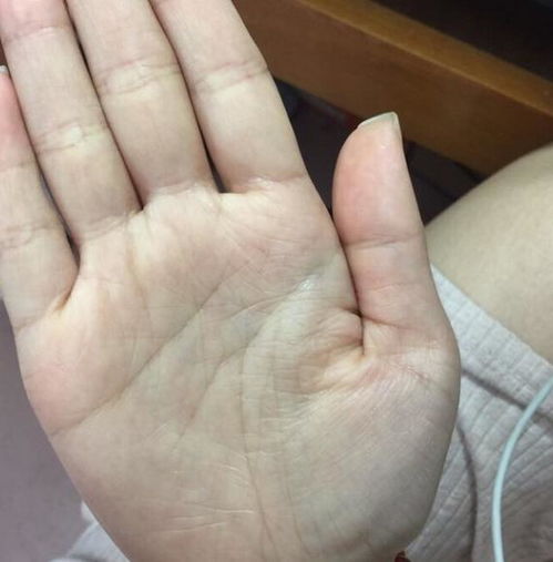 手相中哪些特征预示着可能面临离婚？