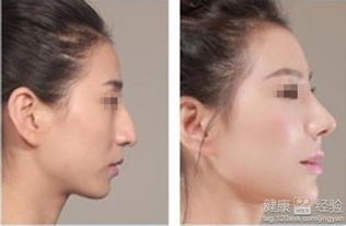 震惊！鹰钩鼻女人竟有这些不为人知的秘密！2026年运势大揭秘