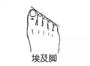 医生看了都摇头！罗马脚的健康警报