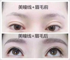 赘眉之命女人指的是什么命运，为何会有这样的称呼？