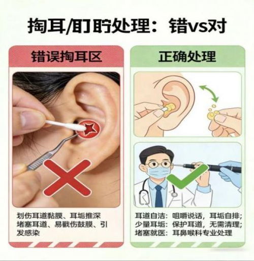耳朵里耳屎过多，应该怎么处理或清洁呢？
