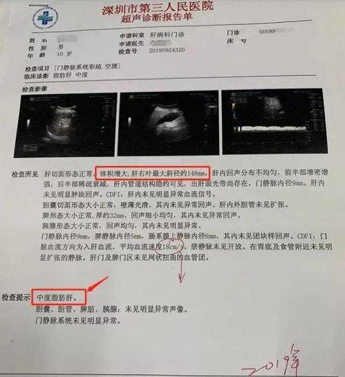 双顶径法公式