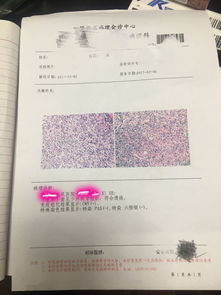 护理评估要点表格化展示