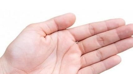 四、 混搭治疗方案：从中医药膳到微创显微减压术，全都搬进来乱写一遍！😂😂😂