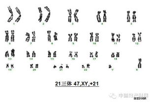 1.1 唐氏征与中国文化底蕴