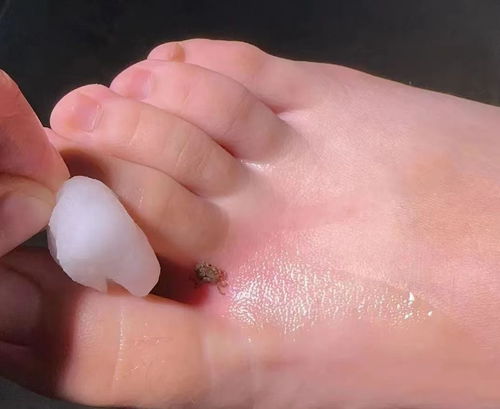 女生脚趾第二个长风水，女性二脚趾长有什么好寓意？