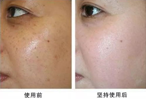 啊！那些藏在皮肤下的神秘力量简直让人疯狂