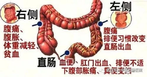 梦见大便从嘴巴吐出是什么征兆或含义的疑问？