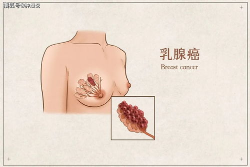 四、心理状态调适：怎样让自己从内而外散发负能量？