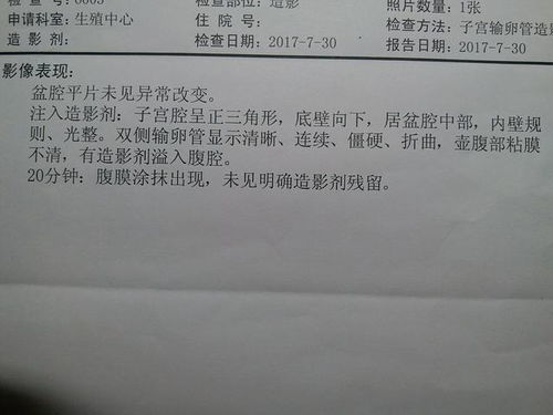 五、怎么准备才能让检查最终还是结果是“不掉链子”？——乱七八糟的较小技巧合集🥴🥴🥴