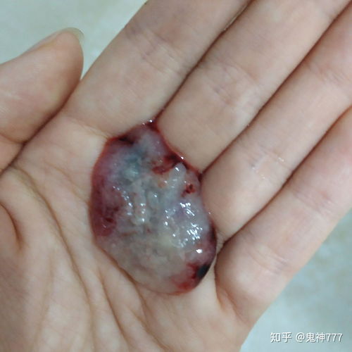 生肖解析：化解孕囊疑虑，  探寻情感和谐之道