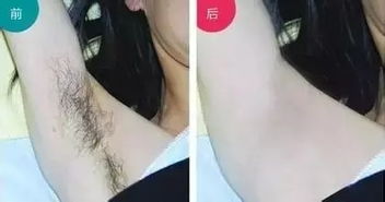 脱腋毛对风水有影响吗？