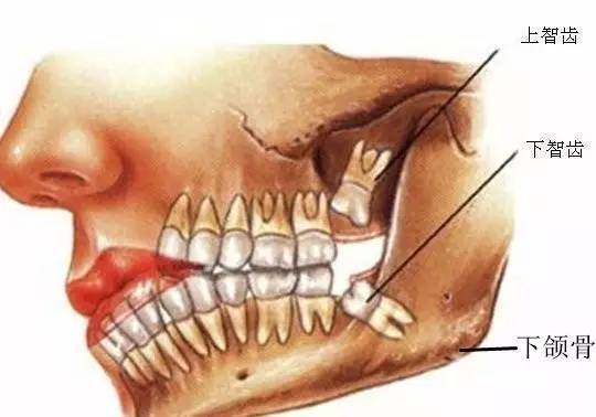 震惊！四颗智齿暗藏惊天秘密！2026年运势大解析