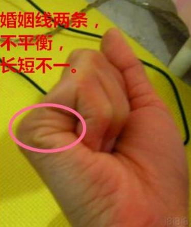 你的手掌正在上演变形记？！