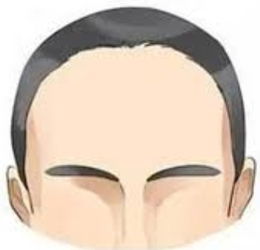 逆天改命第一招：脑门亮得像灯泡