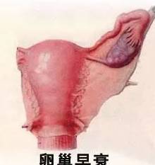 1. 我们到底想了解哪些？——例虚假前后那只奇怪的较小动物——卵巢的“戏法”