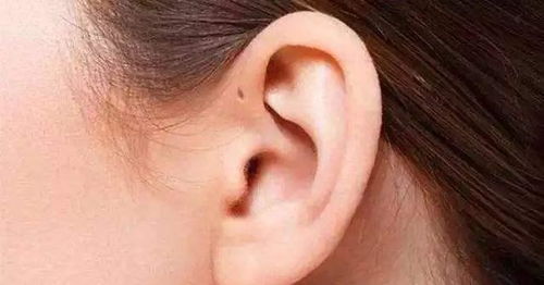 孩子耳朵上天生有小孔，这是否意味着有福气呢？