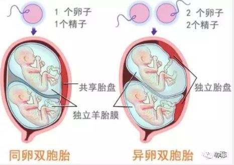 同卵双胞胎性格差异大，命格为何截然不同？