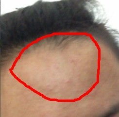 额头鼓包面相命运改写好看吗？