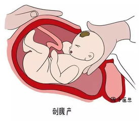 极端命理派：