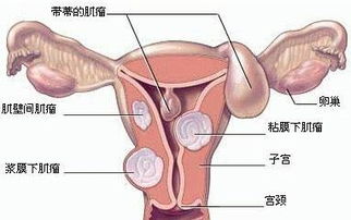 ① 雌激素抑制剂（避孕药）