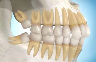 2026年黄历预警：智齿与运势