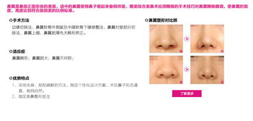 整容手术是否应该结合个人八字命理进行选择和规划？