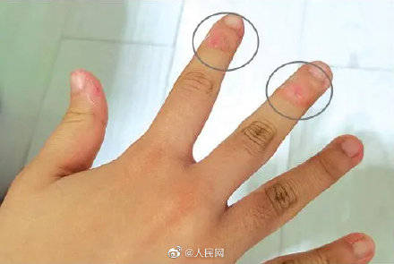 手指如竹节，女生面相能变形吗？