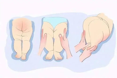 小孩长短腿,风水造成小儿长短腿