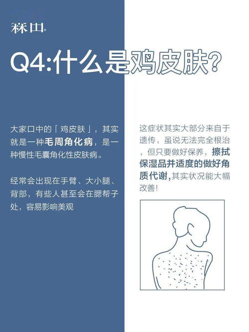 二、 十二生肖皮肤风水较大预测：避坑指南迅速收藏！
