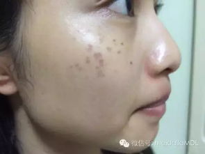 先说说鼻子上的那些事儿