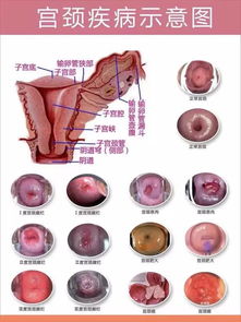 医治方法全攻略（别问为哪些这么详细）