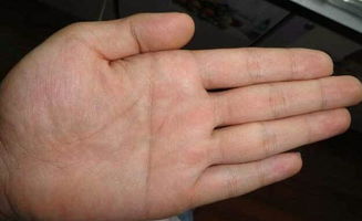女人断掌大富大贵是真的吗？断掌预示着什么命运？