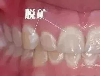 人的牙齿在风水学中真的有特殊作用吗？