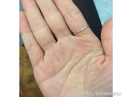 3. 拇指和食指中间横纹——高智商创业狂魔