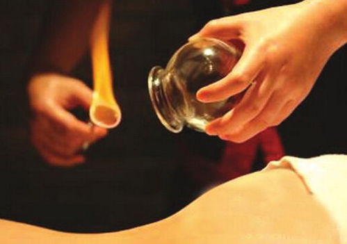 2026年天气预警の拔罐玄学