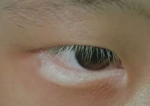 白毛玄学：一根毛引发的血案