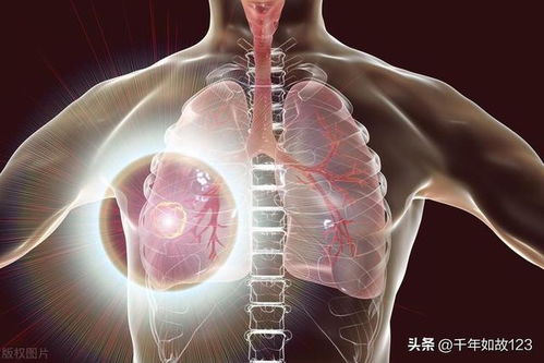 什么风水影响男性脾胃,影响脾胃的风水原因