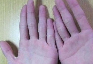 女人断掌：掌心中的神秘力量