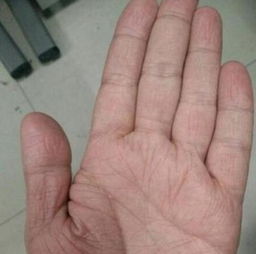 手相事业线分叉及副纹预示着什么？