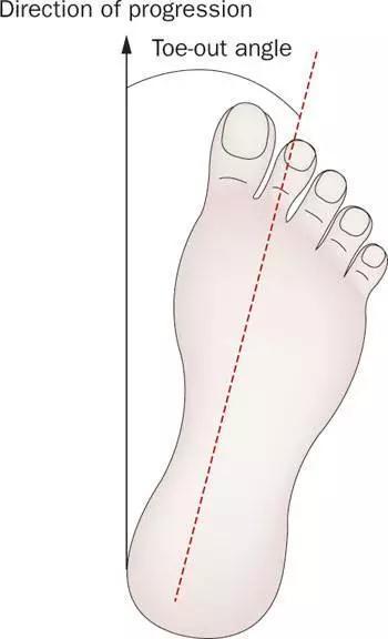 婴儿八字软怎么办,婴儿八字脚如何矫正