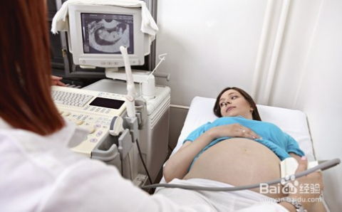 16周孕期Zuo男女鉴定，误诊率是否较高？
