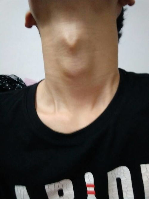头顶长痦子对风水有影响吗？头顶半圆大门风水有哪些禁忌？