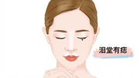 鼻梁有疤痕：情路坎坷难圆满